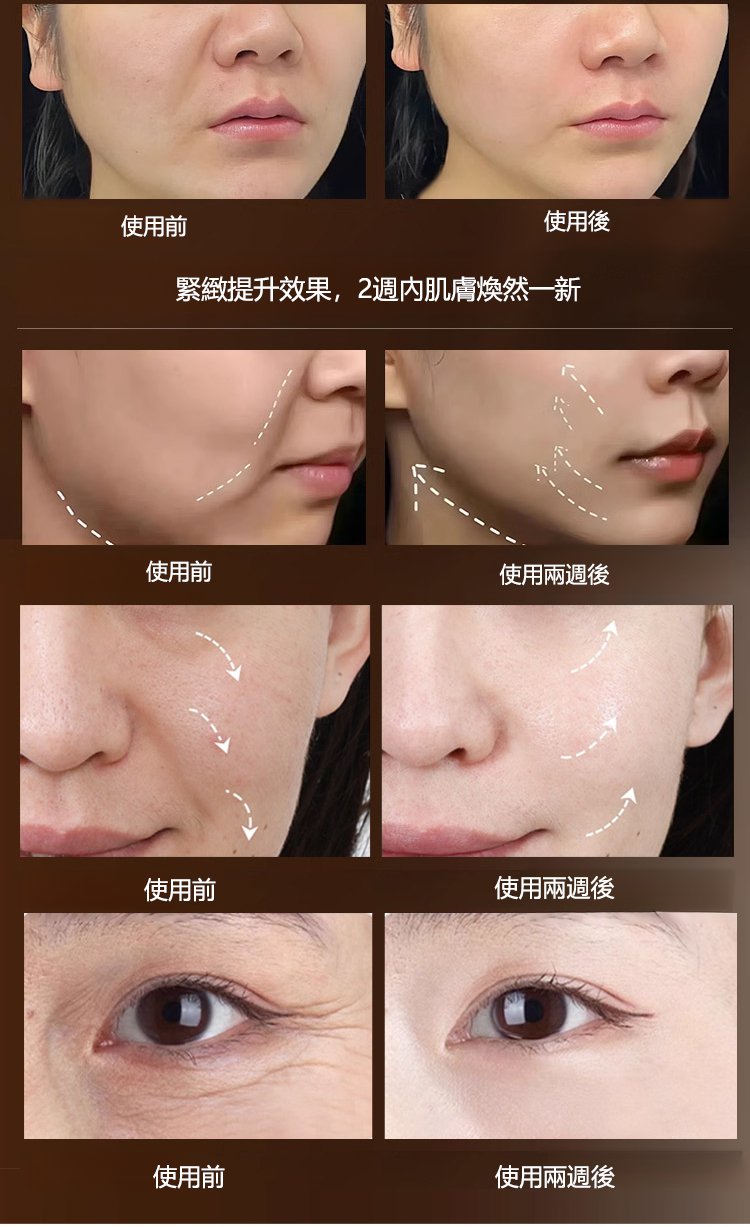 68072060545046677966c3224e10261a63143212816421010725708TW2246b48bd184cc25c1b49b8a53a4df632 KHK重組膠原細胞抗皺水光精華