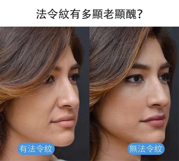 法令紋面膜,UMH悠氫寡肽抗皺御齡凍乾眼膜保濕補水淡細紋黑眼圈5對每盒 7 779ad9705abe2e4f145bf98c5c1ba9653297112260681008722673TW2346ce31bf7ee1577117d19894e89e7bb 法令紋面膜