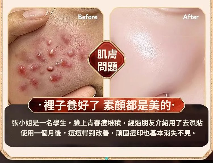 毫醫生祛濕穴位貼 38 79a82e9771466887bf6a048d9cecfc687011529801006319654TW237777559670284b418d7ad8ad36b12a7 毫醫生祛濕穴位貼