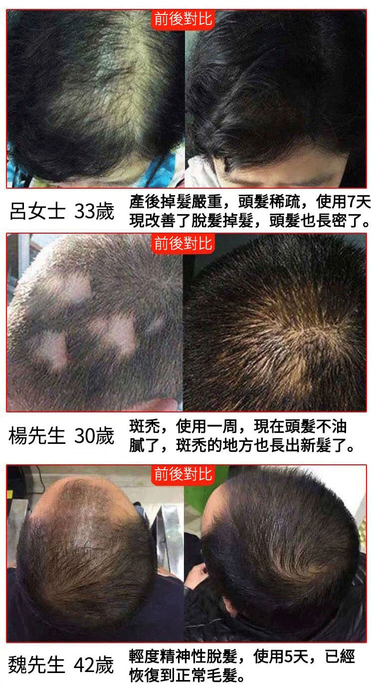 聚容防脫育髮洗髮乳 37 861776c9079fcfe5de71022ac20eafe0147411451671005934663TW209ca6b99b25cfaec95726162e506c4c5 聚容防脫育髮洗髮乳