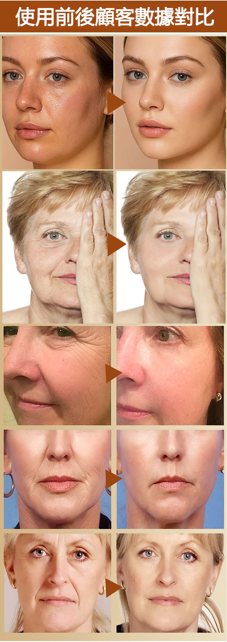 88027de9f35e6ff5b791e9ba8d5009d963143212816421010725708TW2c6b90c3c2e476767ef8ca0b4e5cf1d4d KHK重組膠原細胞抗皺水光精華