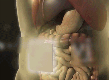 毫醫生祛濕穴位貼 19 8e8e0eae9a365be58b92a261c731222a7011529801006319654TW2eccbc87e4b5ce2fe28308fd9f2a7baf3 毫醫生祛濕穴位貼