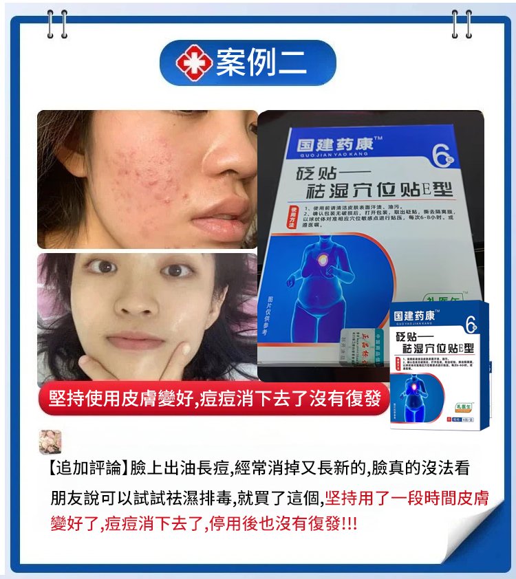 中醫健康祛濕穴位貼,楷醫生去濕穴位E型砭貼去濕驅寒溫熱敷暖貼合穴位貼6貼 中醫健康祛濕穴位貼