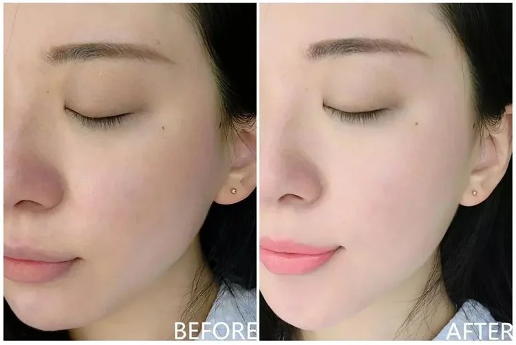 毫醫生祛濕穴位貼 26 8ee2aa6dc956ab701b6383d1ef09421b7011529801006319654TW26f8208daab3fc7133e2f9fbf79462d7b 毫醫生祛濕穴位貼