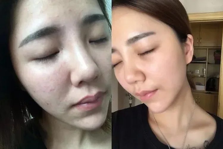 毫醫生祛濕穴位貼 22 8f76f8d983263ab6aa8f114f9c84297c7011529801006319654TW27713ff3ca8fc4a312b98de013e57b330 毫醫生祛濕穴位貼