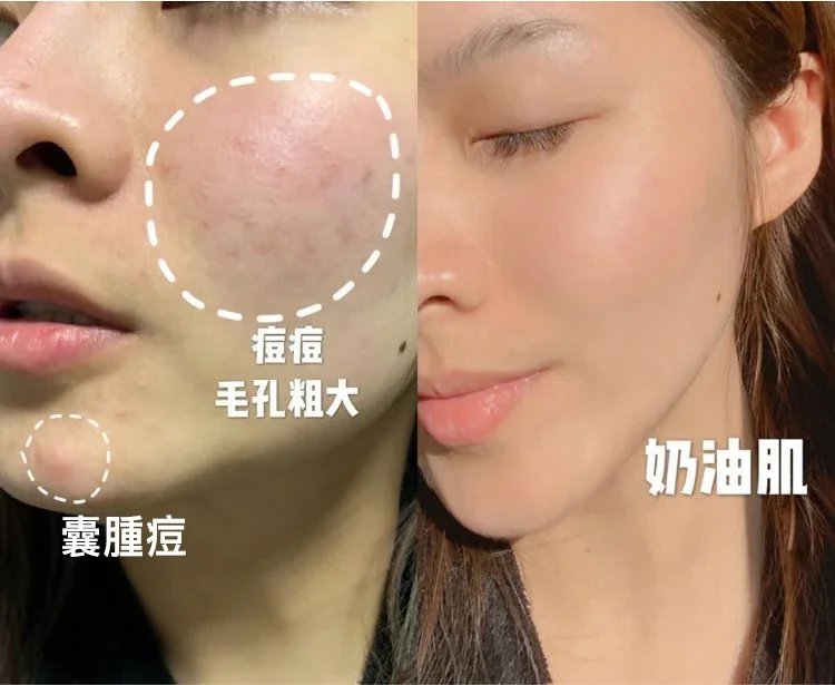 毫醫生祛濕穴位貼 24 af8b27d27d581176e320fef8c276b1a27011529801006319654TW2b8fa21992b1f191f98b32d92f0dcd861 毫醫生祛濕穴位貼