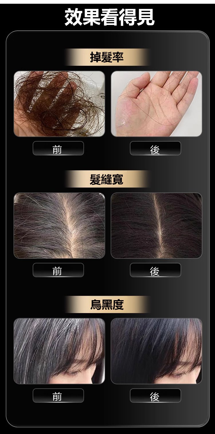 國藥本草烏參九黑片,內外調養烏黑茂密養發護發草本配方36粒每瓶 14 b2178adedd47958cc58aea74496e79fc176012341671009101853TW2c6b90c3c2e476767ef8ca0b4e5cf1d4d國藥本草烏參九黑片