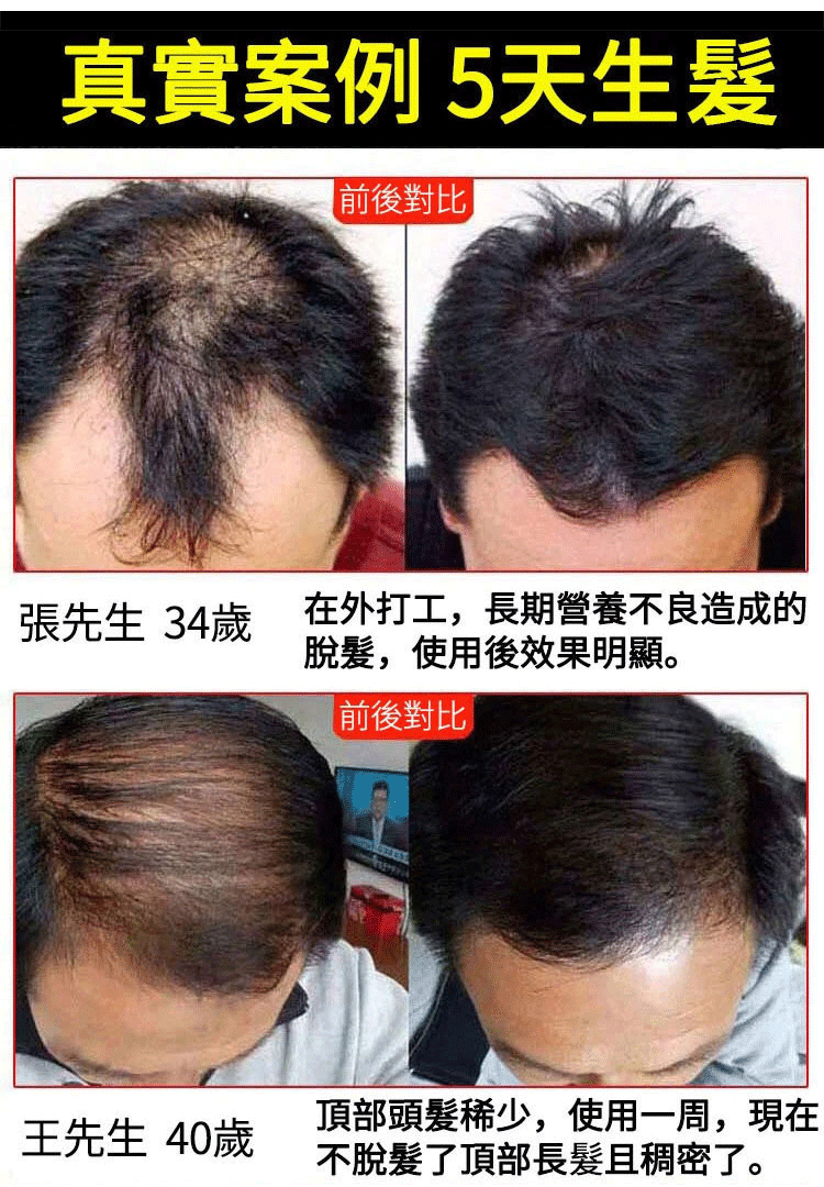 聚容防脫育髮洗髮乳 36 b2af0f626a861a269b5fb95ea4f8036b147411451671005934663TW2c74c80e47f40028bda24ccbec741885c 聚容防脫育髮洗髮乳