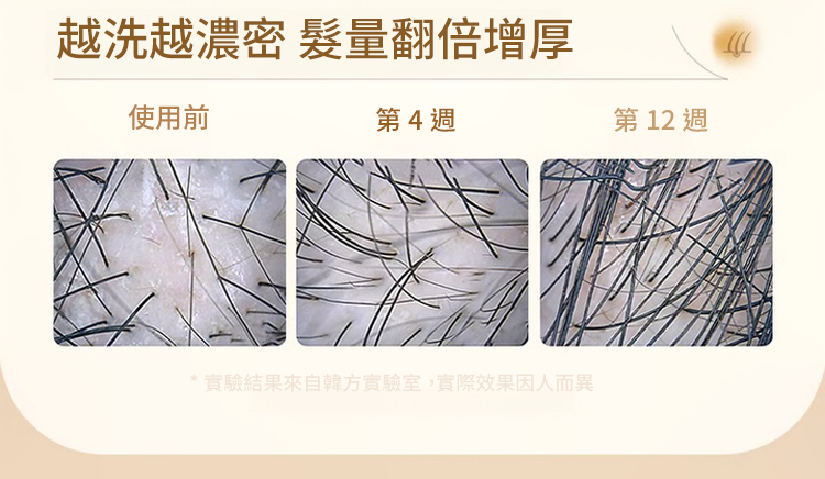 聚容防脫育髮洗髮乳 25 d3beb959cf408eaf5b3493b021060775147411451671005934663TW24b3617dd50b606d8b91d17859448efee 聚容防脫育髮洗髮乳