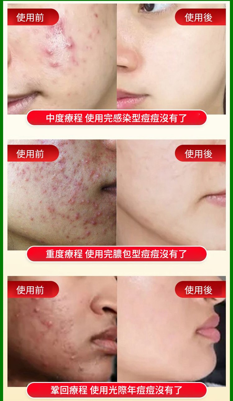 【潤腸通便】李時珍清青膠囊 17 d7b718f488c712c34551e00a9405f61063107211554951006396591TW2e09a885b1cb8963a57448075a1c6944d 【潤腸通便】李時珍清青膠囊