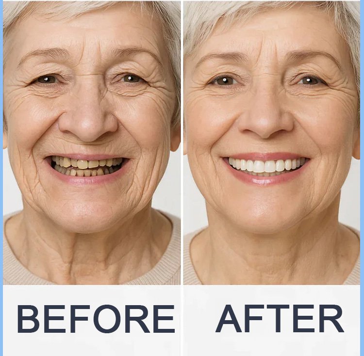 Yagoo™ Medical Full Denture image Yagoo™ Medical Full Denture