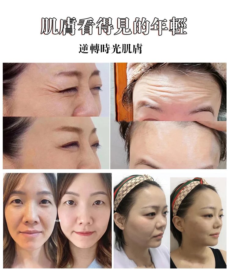 勻美博士人參精粹抗皺煥顏精華液 28 f8bcf1770e0ead74b0f68d7aa177e71963107211482421006087904TW242332d05f208948ce948e6107e55e5d7 勻美博士人參精粹抗皺煥顏精華液