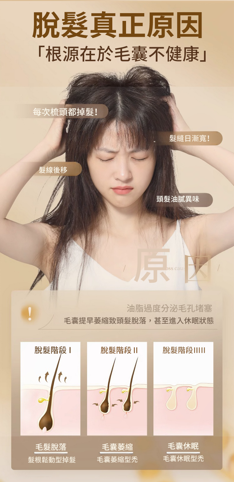 聚容防脫育髮洗髮乳 9 fcdb916a6c72cf6b341288691d490360147411451671005934663TW23be72d91c4cfdb6e3bff7f8fc09d109c 聚容防脫育髮洗髮乳