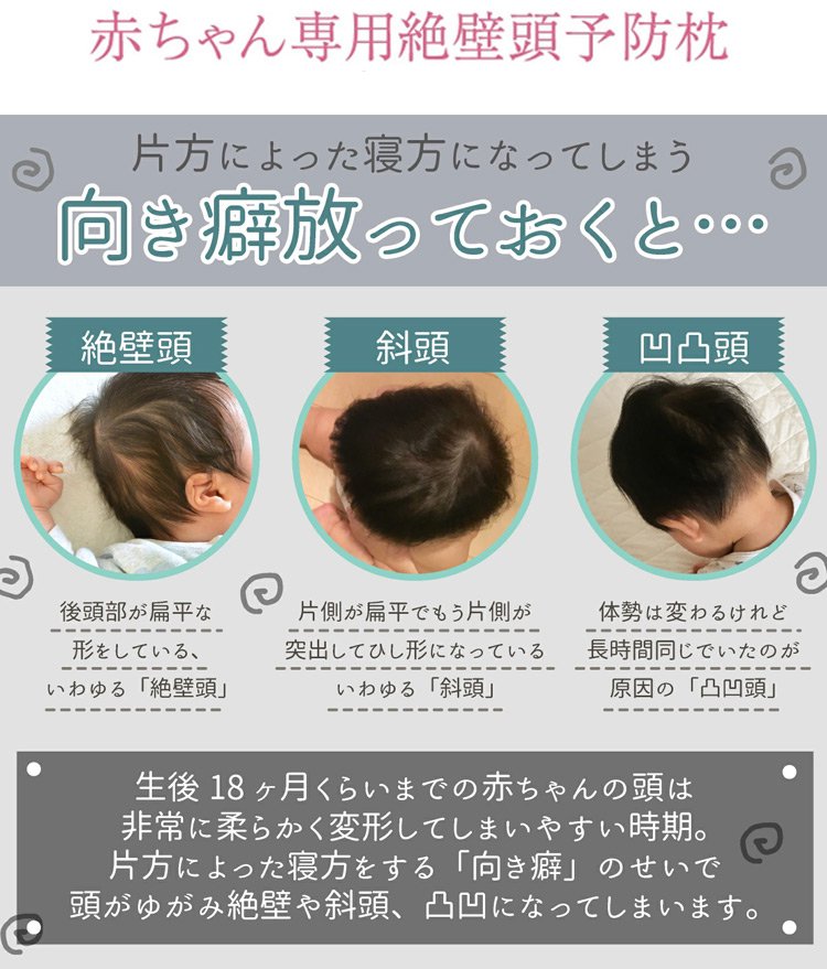 向き癖防止ベビー枕 科学的な睡眠 4d立体デザイン 吸水 速乾 快適な姿勢と寝心地を実現 Aiyfu Com