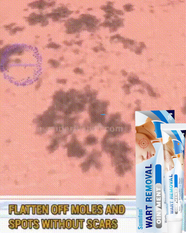 Sumifun 祛疣膏