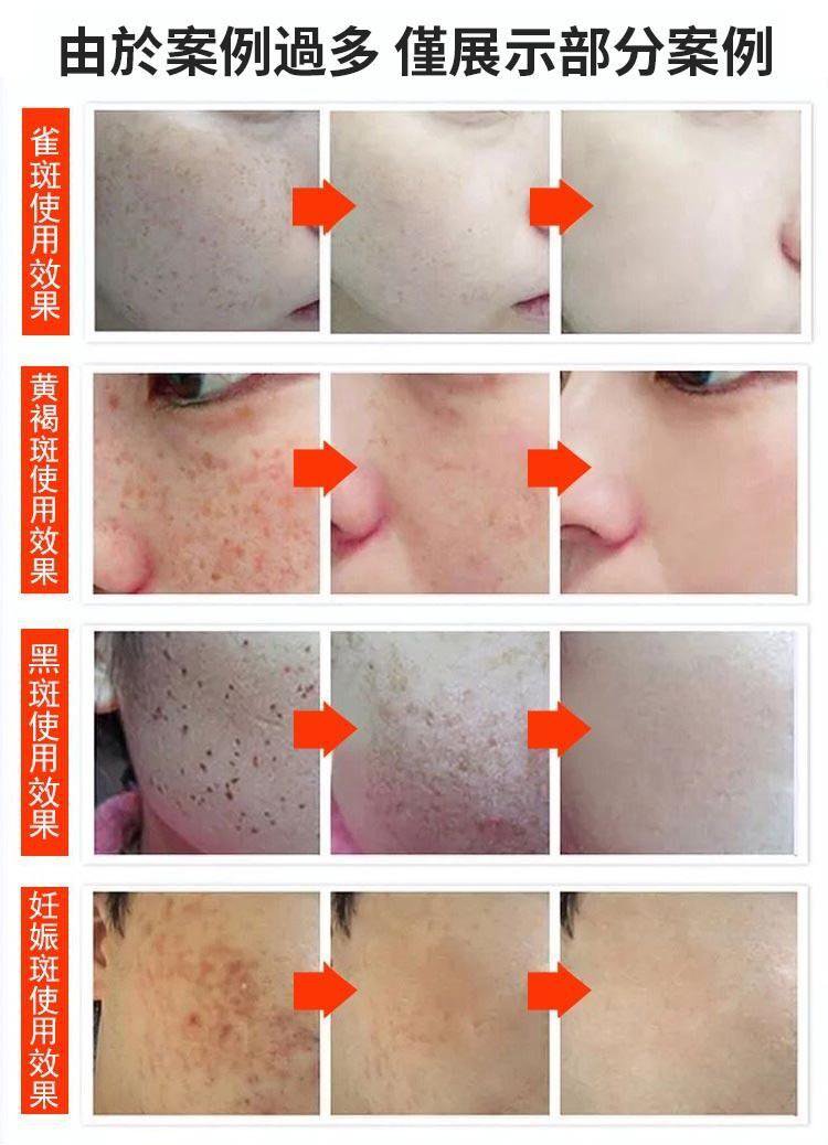 1625628042547504.jpg 1625628042547504 【吳醫師研裂好物】中藥淡斑霜,每日一用,皮膚水嫩又白皙!