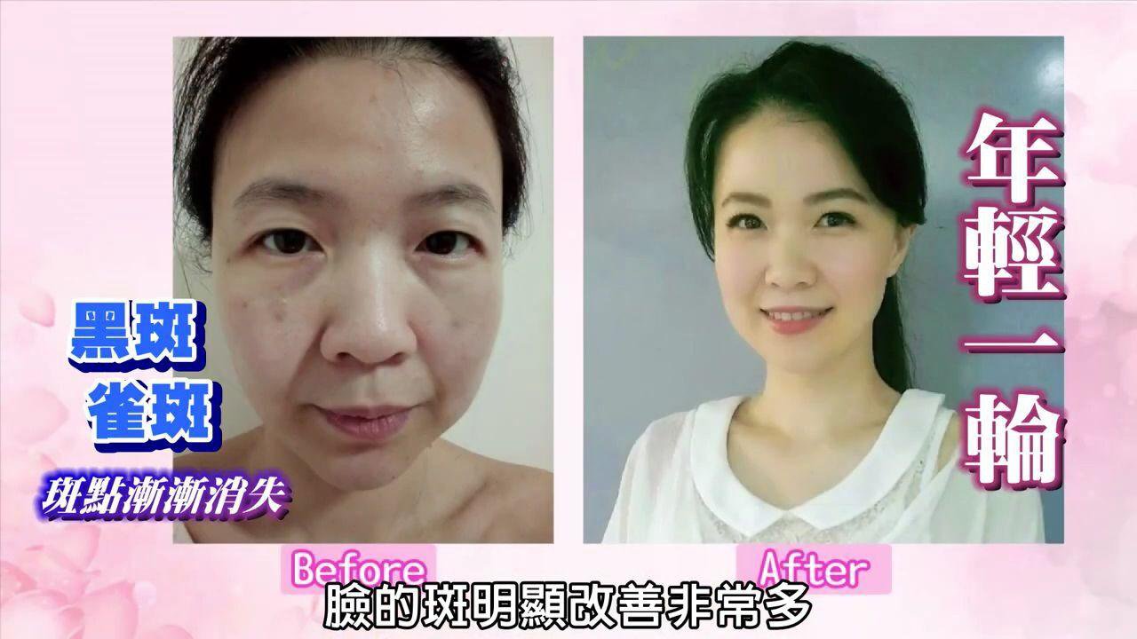 1625628042615087.jpg 1625628042615087 【吳醫師研裂好物】中藥淡斑霜,每日一用,皮膚水嫩又白皙!