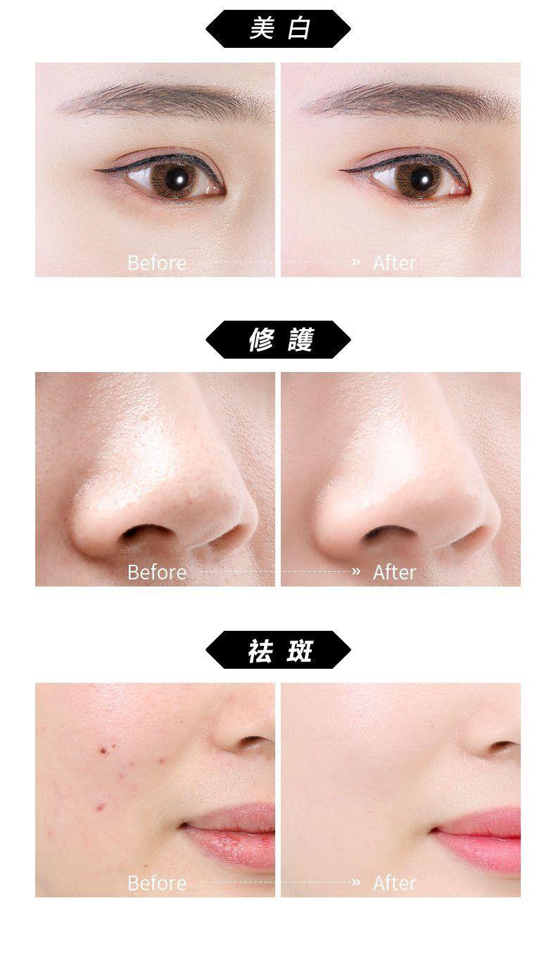 1625628042868442.jpg 1625628042868442 【吳醫師研裂好物】中藥淡斑霜,每日一用,皮膚水嫩又白皙!
