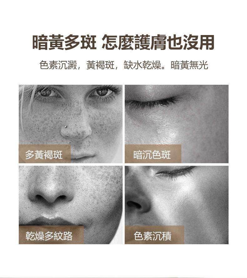 1625628241134429.jpg 1625628241134429 【吳醫師研裂好物】中藥淡斑霜,每日一用,皮膚水嫩又白皙!