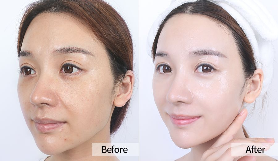 1635503882656138.png 日本峰王乳凝露7.png