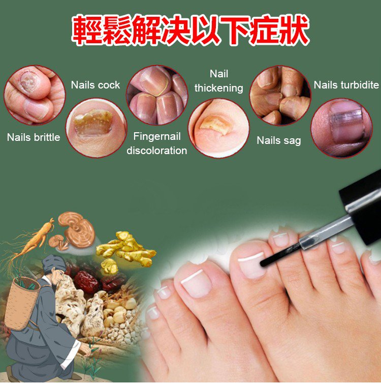 kinbt灰指甲膏1640249253937296.jpg 1640249253937296 kinbt灰指甲膏