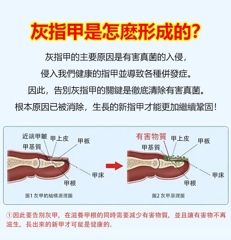 kinbt灰指甲膏1640249257260441.jpg 1640249257260441 kinbt灰指甲膏