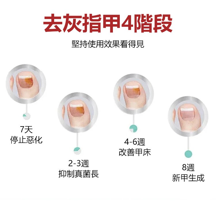 kinbt灰指甲膏1640249259246583.jpg 1640249259246583 kinbt灰指甲膏