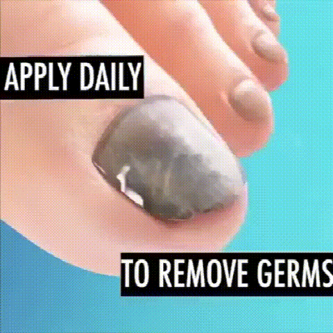 kinbt灰指甲膏1640249523597281.gif 2.gif