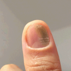 kinbt灰指甲膏1640249634261605.gif 8.gif
