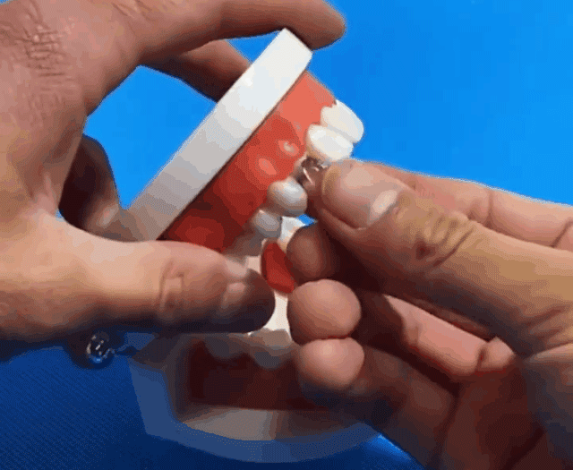 可塑性牙膠 7 04f0251dc1f7cf74a00c3a28b78b7adc 可塑性牙膠