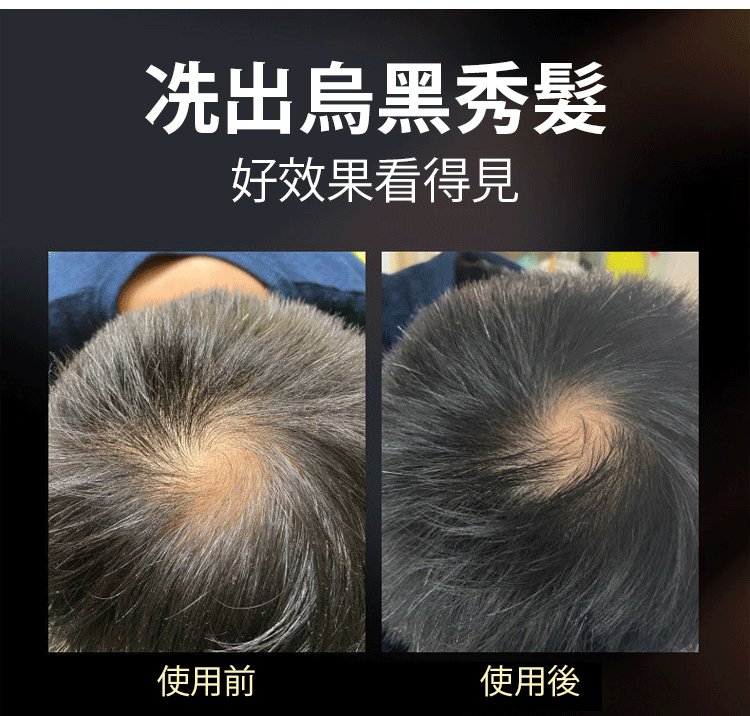 南京同仁堂靈芝人參何首烏白轉黑洗髮皂何首烏洗髮皂洗頭側柏葉洗髮皂手工皂角中藥純天然頭髮白轉黑皂100克每盒 南京同仁堂靈芝人參何首烏白轉黑洗髮皂