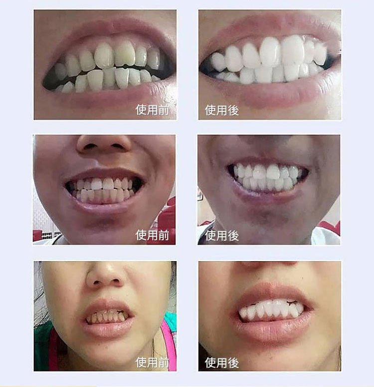 可立克蜂毒牙膏