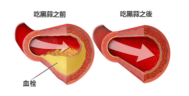 百未草黑蒜油凝膠糖果