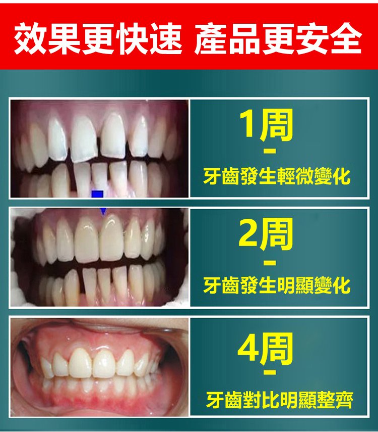 牙齒晃動牙膏 2 0d2108b0fff550b51b4e9e855265e939 牙齒晃動牙膏
