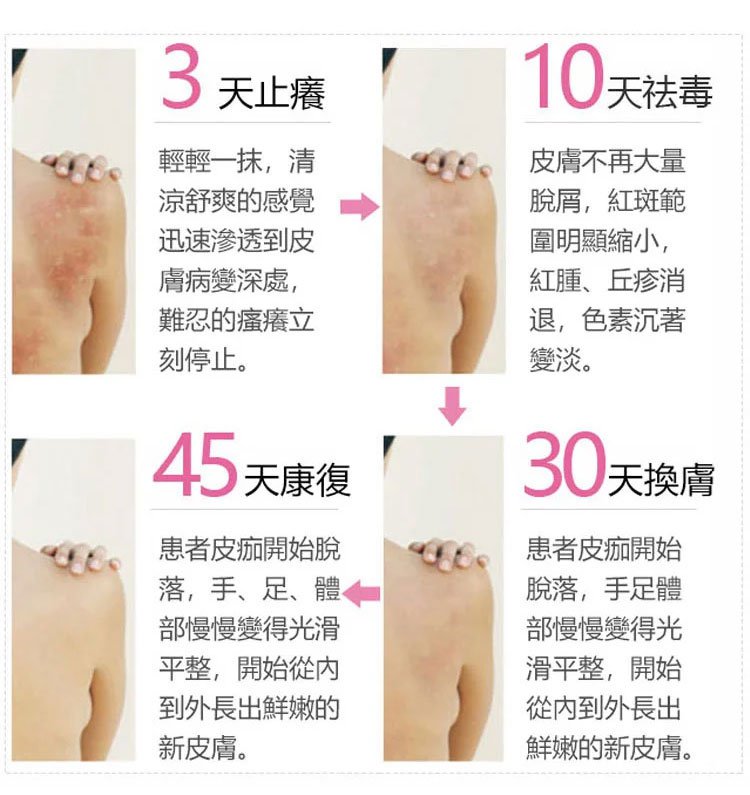 South Moon手蘚腳氣噴霧 34 0e8054802046b0bc4ad628a00c56b3ee South Moon手蘚腳氣噴霧