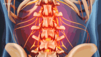 醫療用護腰帶 15 3731e74564a66185916d0ce7063ad450.gif