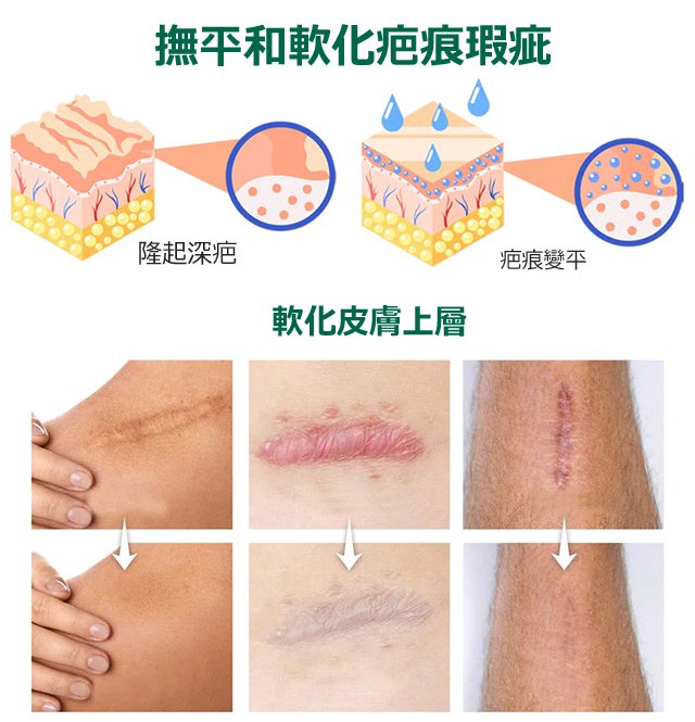 elaimei疤痕