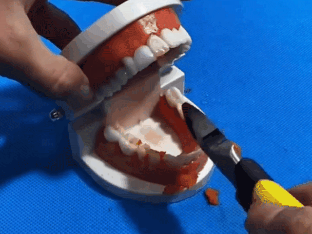 可塑性牙膠 18 208f14df21f7d1b356c12ec00f57f680 可塑性牙膠