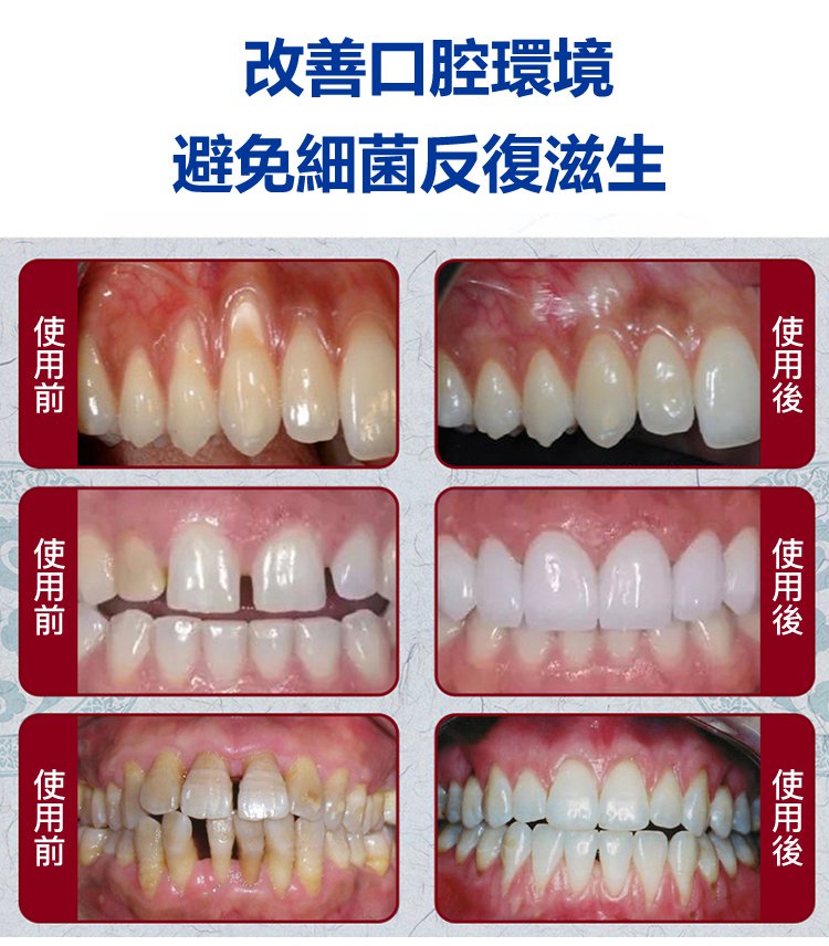 牙齒晃動牙膏 17 2231b33f0cd3813a7c03da96cc1b3e9a 牙齒晃動牙膏