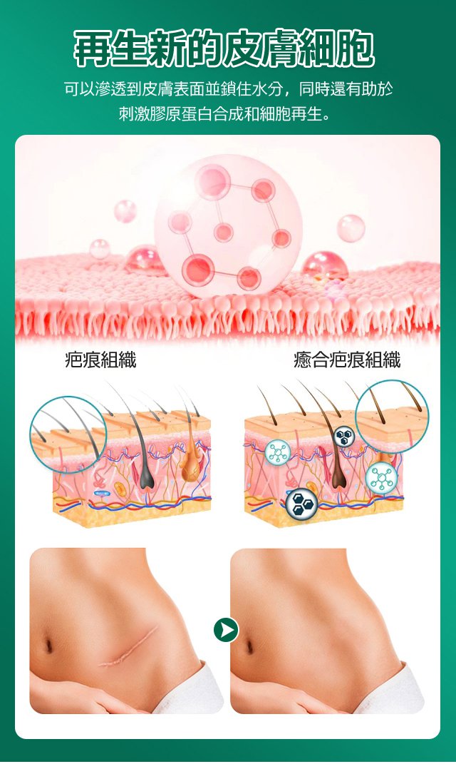 elaimei疤痕