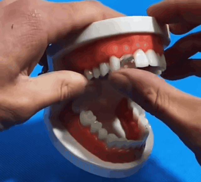 可塑性牙膠 9 2563de302a922c0106764b55e52a87cc 可塑性牙膠