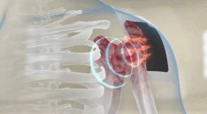 蒙澳神遠紅外腰椎貼