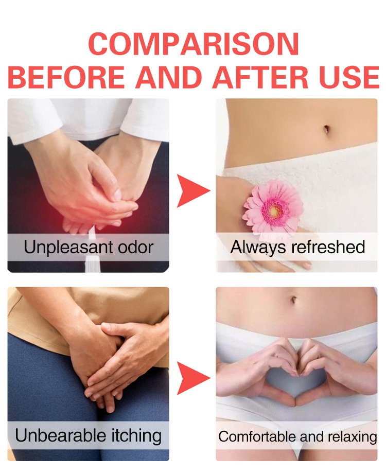 女性专用抗菌舒缓霜_20.jpg