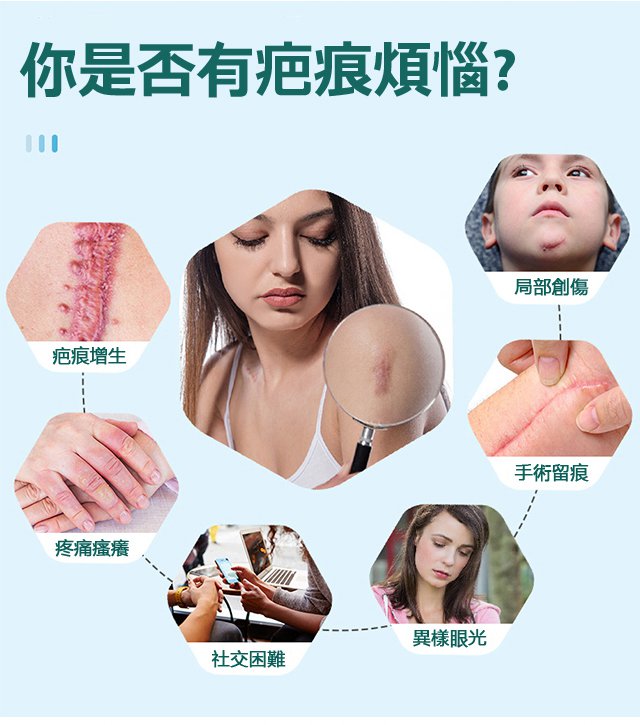 elaimei疤痕