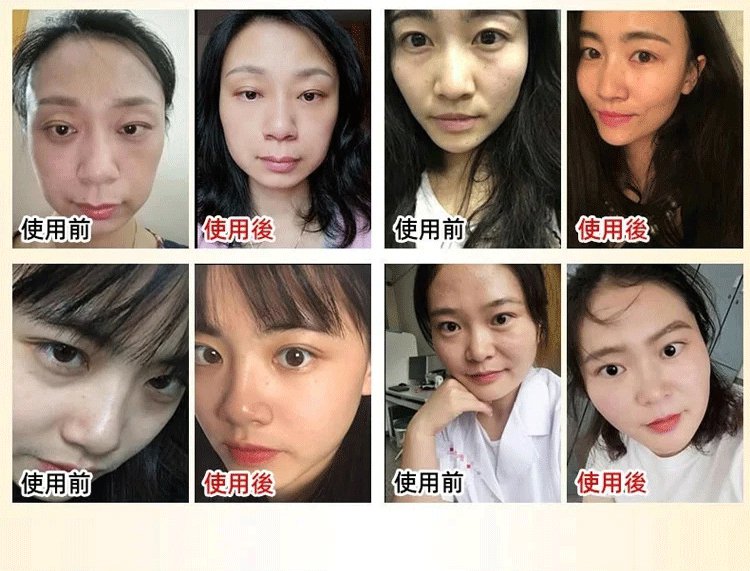 膠原蛋白填充霜 膠原蛋白填充霜