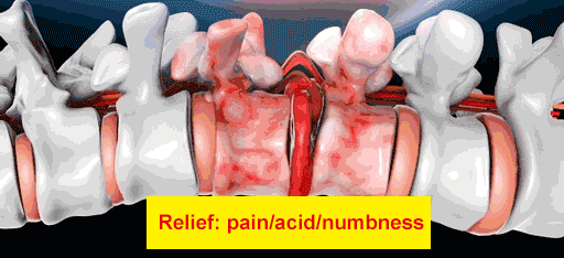 蒙澳神遠紅外腰椎貼