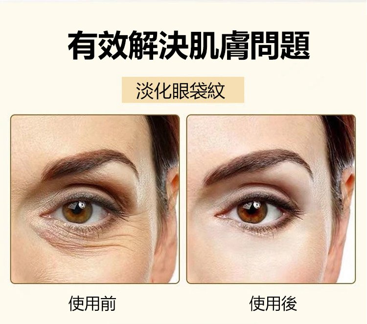 膠原蛋白填充霜 膠原蛋白填充霜