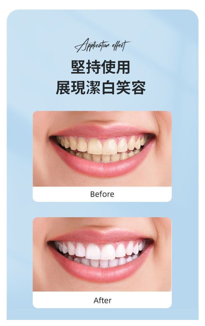 BisuTang益生菌牙膏 28 4821dd68b86f7aa8de23c7b1112bd69f BisuTang益生菌牙膏