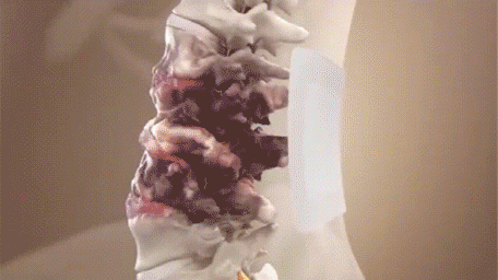 蒙澳神遠紅外腰椎貼