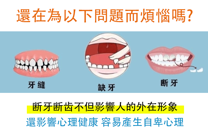 可塑性牙膠 1 4f9be824eff820564a3c688c18bcb43c 可塑性牙膠